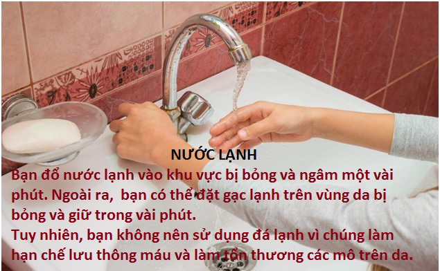 10 mẹo chữa bỏng tại nhà hiệu quả - Ảnh 1.