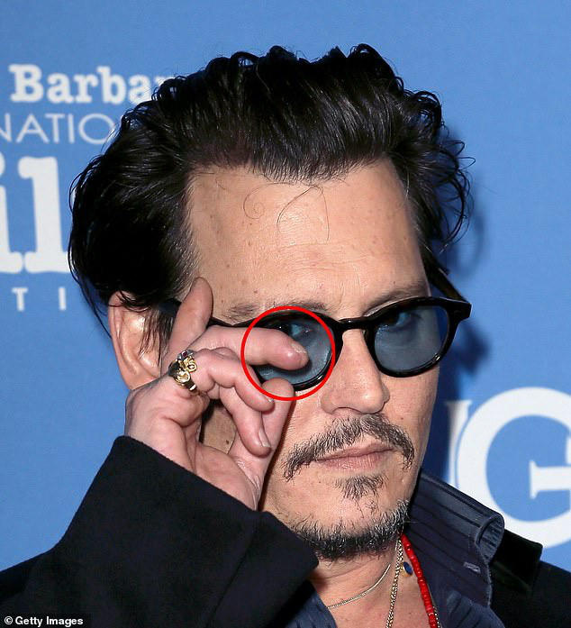 The truth about Johnny Depp's nearly severed finger 5 years ago - Photo 2.