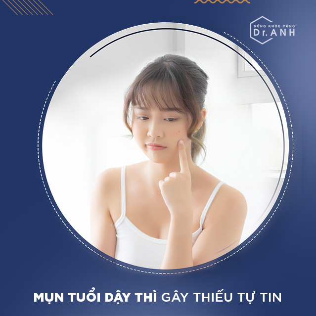 Cơ chế hình thành mụn tuổi dậy thì dưới lăng kính khoa học - Ảnh 1.