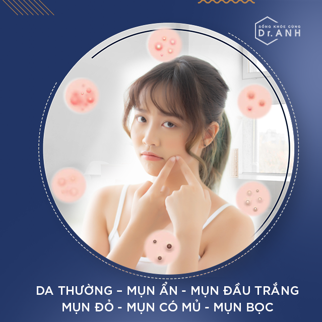 Cơ chế hình thành mụn tuổi dậy thì dưới lăng kính khoa học - Ảnh 2.