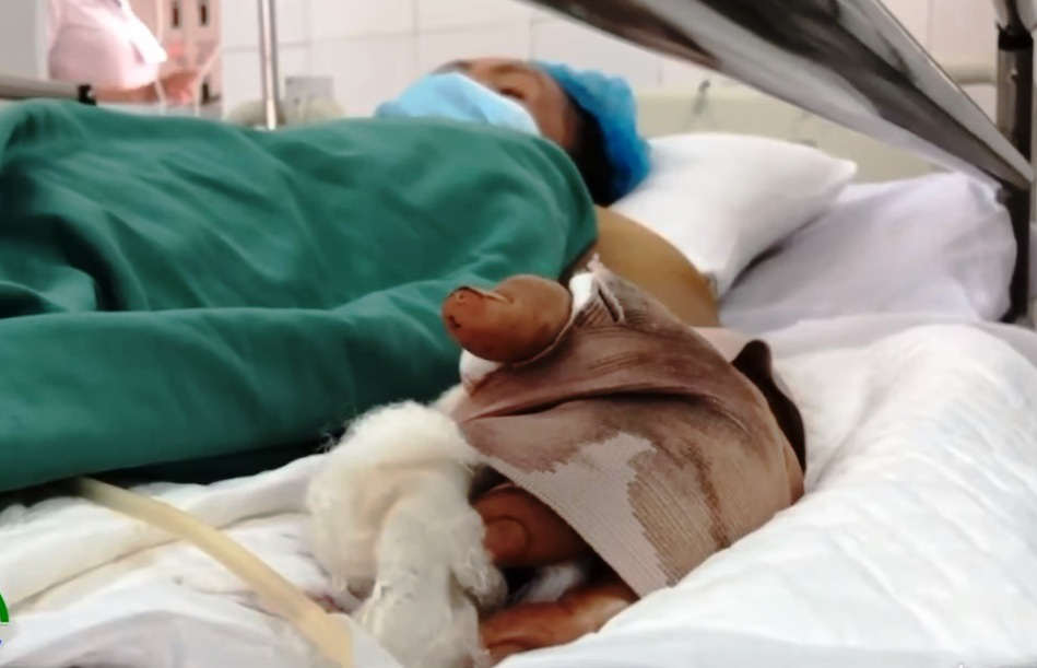 Trồng sả để phòng rắn, 2 người bị rắn cắn - Ảnh 2. Trồng sả để phòng rắn, 2 người bị rắn cắn - Ảnh 2.