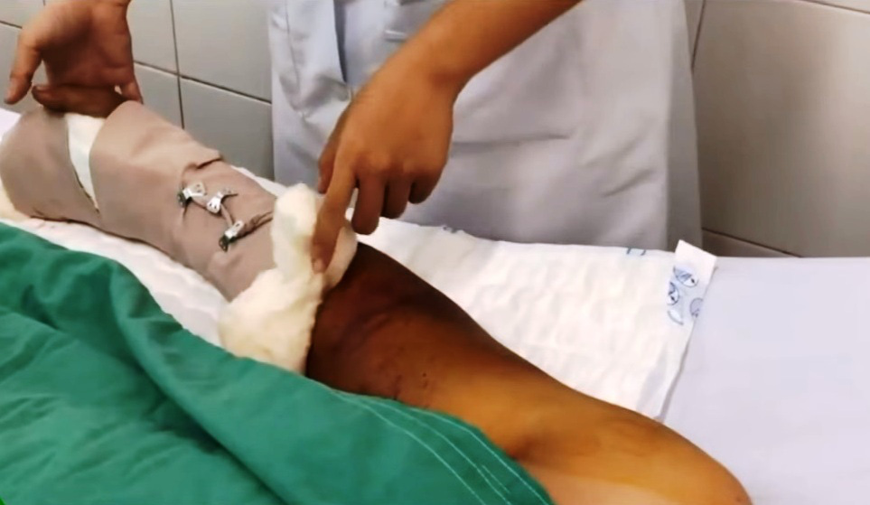 Trồng sả để phòng rắn, 2 người bị rắn cắn - Ảnh 1. Trồng sả để phòng rắn, 2 người bị rắn cắn - Ảnh 1.