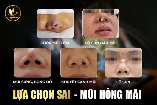 Sửa mũi hỏng, chữa tâm hồn - Ảnh 1.