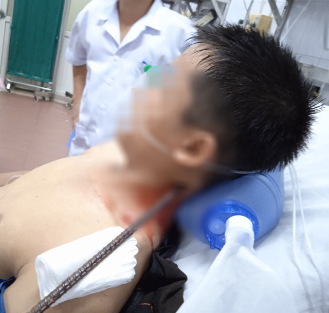 Tai nạn lao động, nam thanh niên bị thanh sắt dài 1m xuyên thấu từ cổ qua não - Ảnh 1. Tai nạn lao động, nam thanh niên bị thanh sắt dài 1m xuyên thấu từ cổ qua não - Ảnh 1.