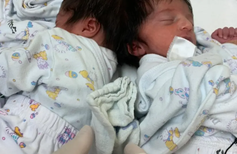 Israel tách thành công cặp song sinh dính liền đầu sau ca phẫu thuật kéo dài 12 giờ - Ảnh 1. Israel tách thành công cặp song sinh dính liền đầu sau ca phẫu thuật kéo dài 12 giờ - Ảnh 1.