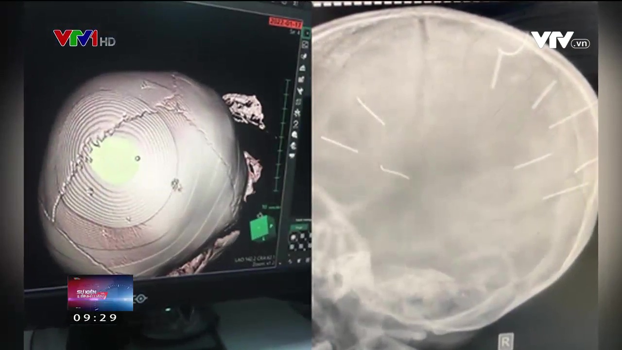 Li&ecirc;n tiếp c&aacute;c vụ bạo h&agrave;nh trẻ em g&acirc;y chấn động: Mới chỉ l&agrave; phần nổi của tảng băng ch&igrave;m - Ảnh 2.