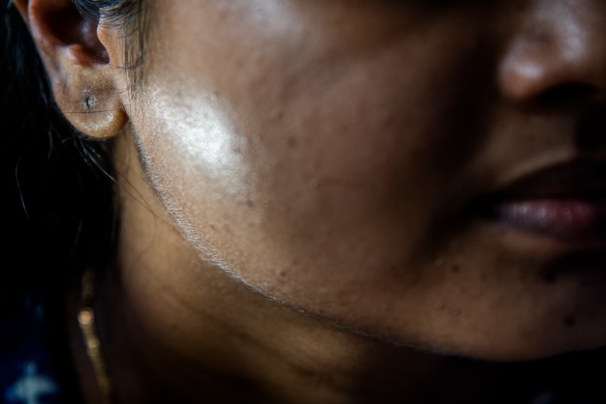 Chứng cuồng da trắng đang đẩy phụ nữ Ấn Độ v&agrave;o nguy hiểm - Ảnh 4.