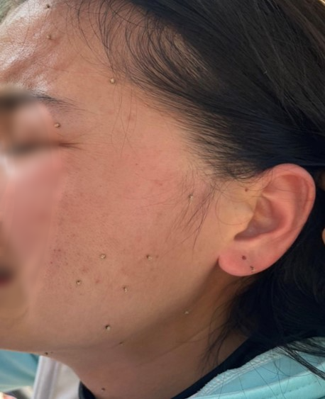 Cấp cứu nhiều bệnh nhân bị ong đốt - Ảnh 1. Cấp cứu nhiều bệnh nhân bị ong đốt - Ảnh 1.