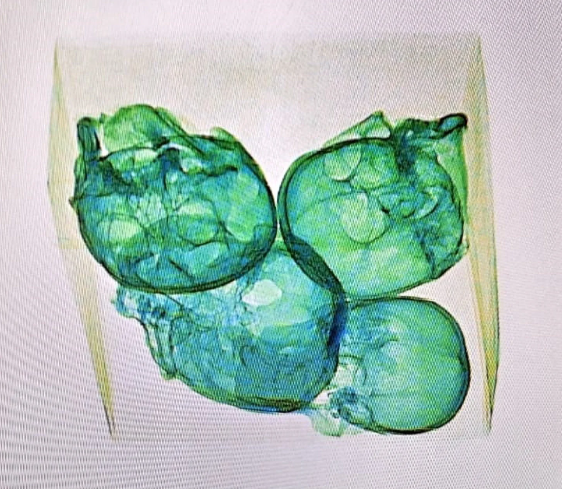 Mexico: Ph&aacute;t hiện 4 hộp sọ người trong kiện h&agrave;ng chuyển đến Mỹ  - Ảnh 1.