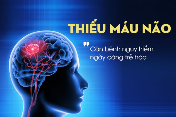 Gabacitin - Bí quyết cải thiện tình trạng thiếu máu não của Dược phẩm Medstand - Ảnh 1.