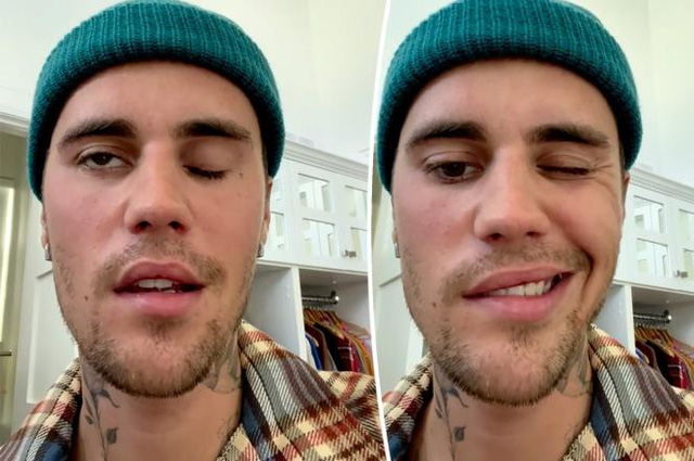 Justin Bieber được vợ chăm sóc hết mực sau khi bị liệt nửa mặt - Ảnh 1.