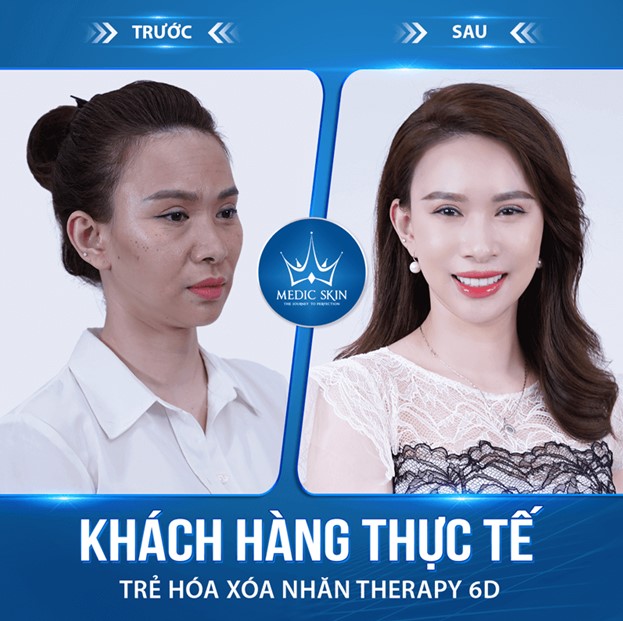 Sở hữu làn da không tuổi tại VTM quốc tế Medic Skin - Ảnh 4.