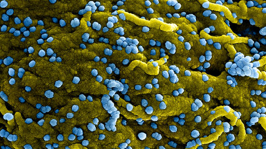 Bùng phát virus Marburg gây tử vong cao ở Tanzania - Ảnh 1.