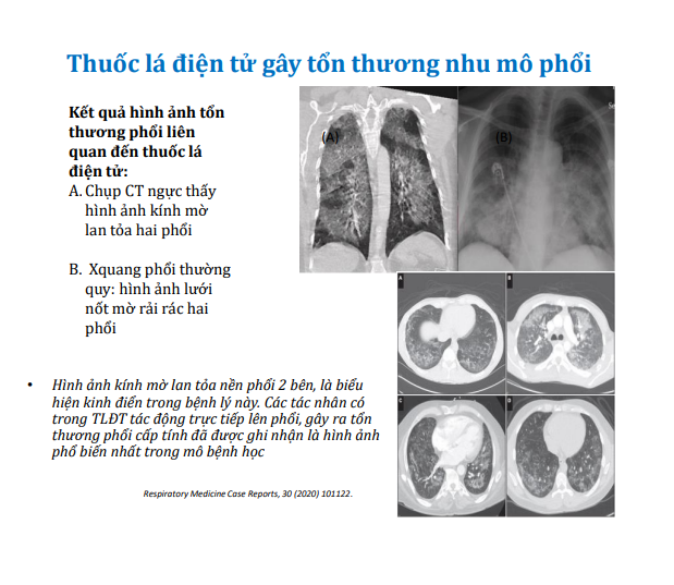 Cần hành động khẩn cấp để bảo vệ trẻ em, ngăn chặn thuốc lá điện tử - Ảnh 2.