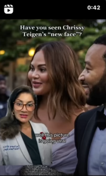 Chrissy Teigen tức giận trước tin đồn phẫu thuật thẩm mỹ - Ảnh 1.