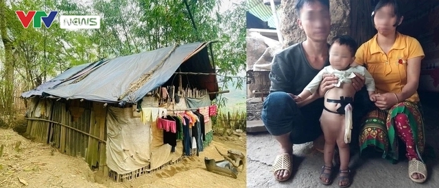 Ca đại phẫu cứu em bé Hmông bị dị tật không có hậu môn và những khoảnh khắc khó quên - Ảnh 2. Ca đại phẫu cứu em bé Hmông bị dị tật không có hậu môn và những khoảnh khắc khó quên - Ảnh 2.
