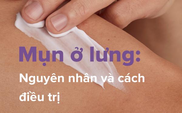 Mụn ở lưng: Nguyên nhân và cách điều trị - Ảnh 1.