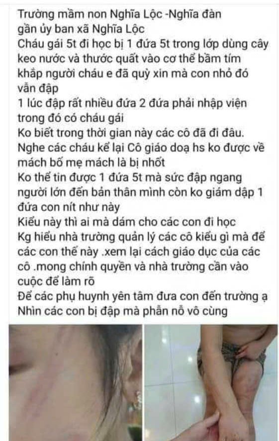 Nhiều trẻ mầm non bị bạn đánh bầm tím cơ thể tại lớp học - Ảnh 2.