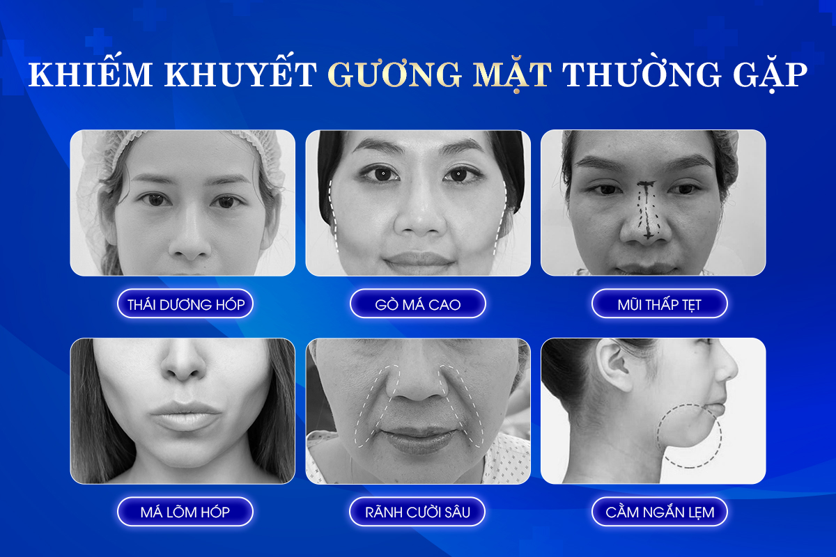 Chuyên gia chia sẻ về giải pháp khôi phục thiếu tổ chức gương mặt - Ảnh 1.