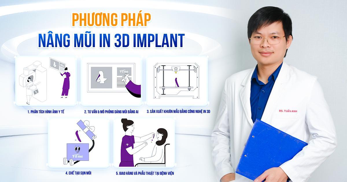 Bác sĩ thẩm mỹ Nguyễn Tuấn Anh giải đáp thắc mắc về công nghệ Nâng mũi In 3D Implant - Ảnh 1.