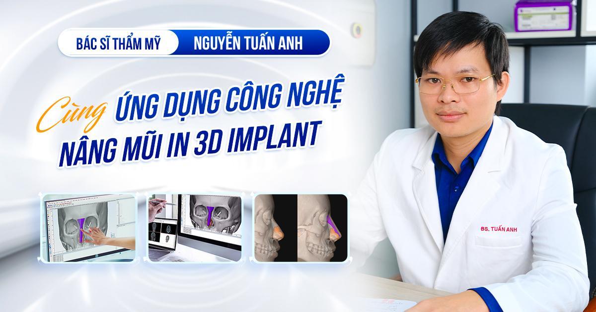 Bác sĩ thẩm mỹ Nguyễn Tuấn Anh giải đáp thắc mắc về công nghệ Nâng mũi In 3D Implant - Ảnh 2.