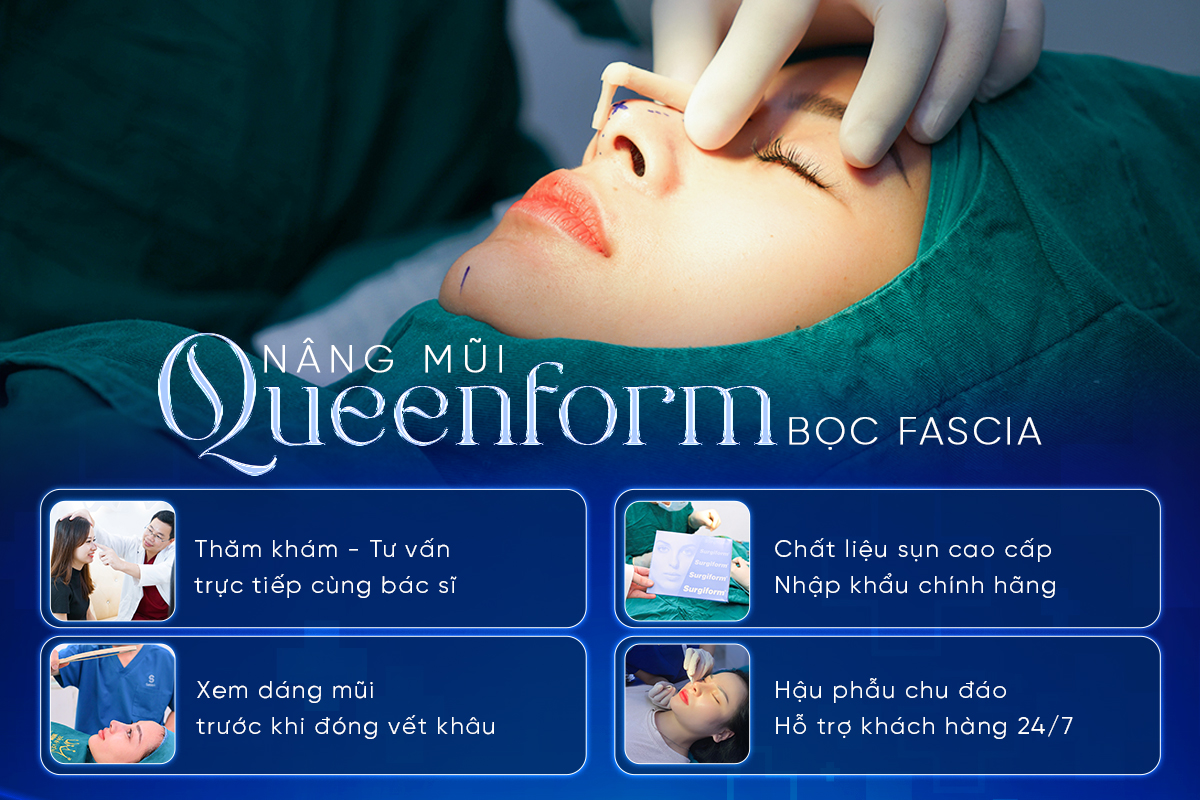 Ths.BS B&ugrave;i Văn Cường chia sẻ về sự thay đổi trong xu hướng n&acirc;ng mũi hiện đại- Ảnh 4.