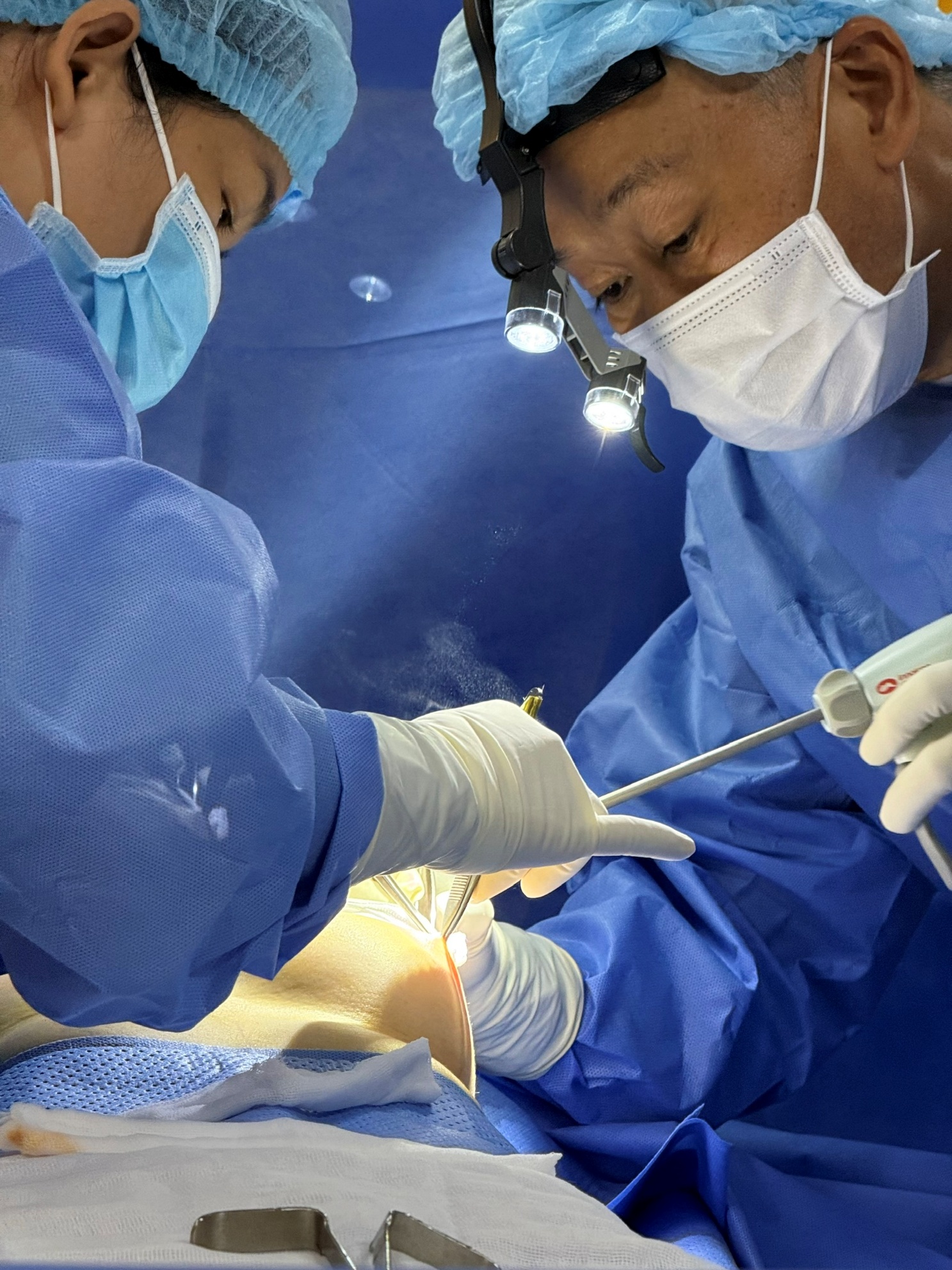 Breast augmentation 4 years ago – unexpected foreign body discovered in the breast - Ảnh 1.