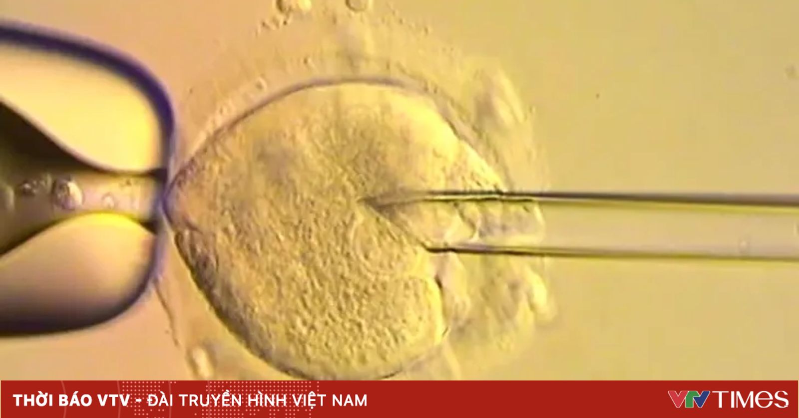 8 em bé ra đời nhờ phôi thai có ADN từ 3 người