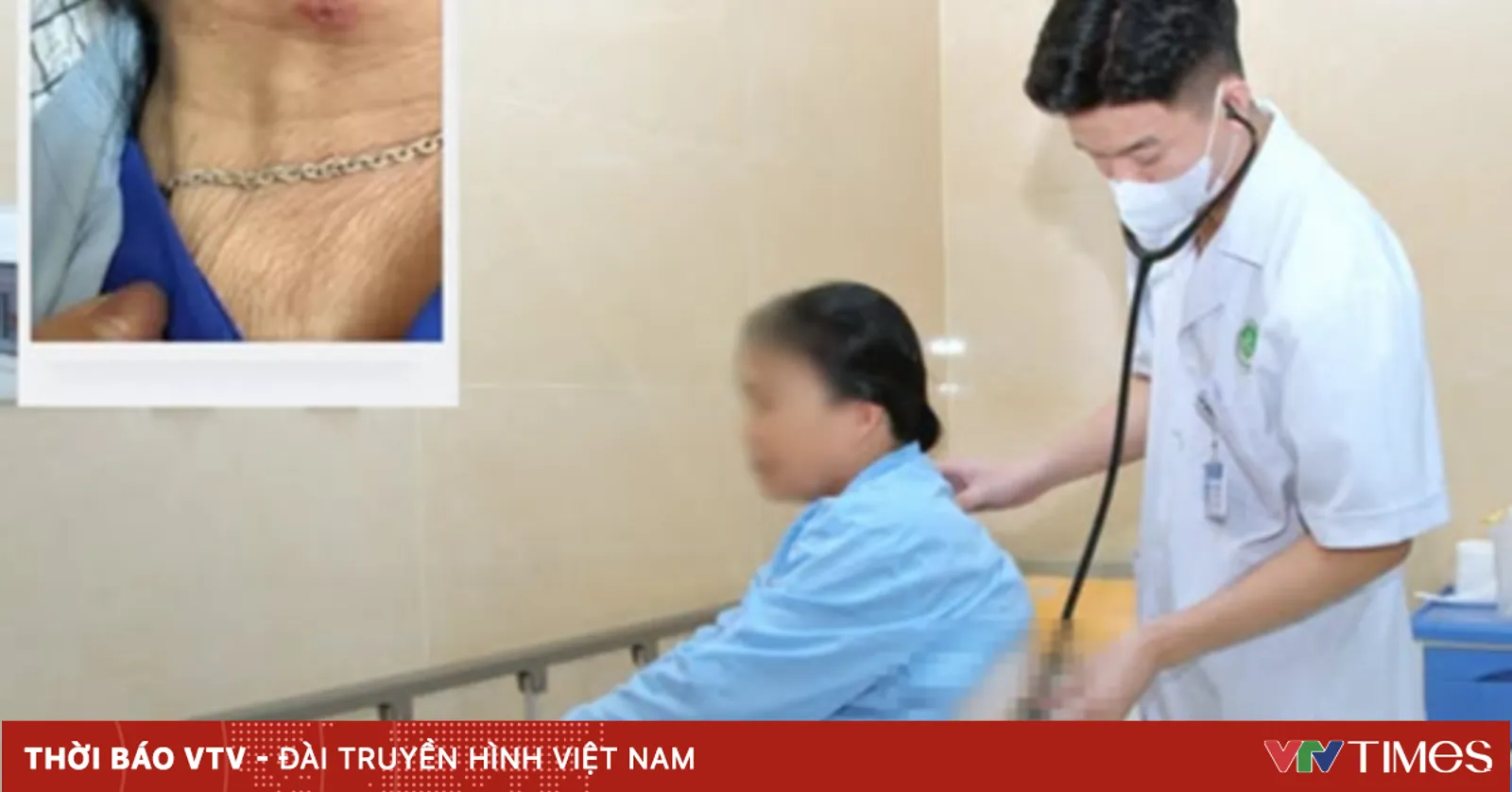 Sốt mò có thể gây biến chứng nguy hiểm nếu phát hiện muộn