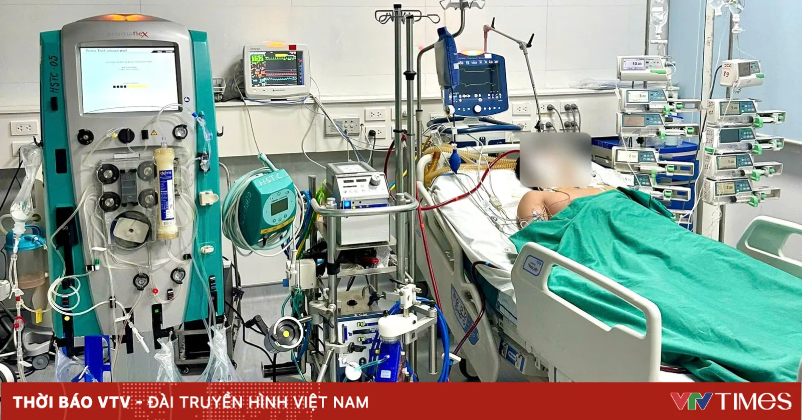 Sốt xuất huyết gây sốc, suy hô hấp ở người trẻ khỏe mạnh