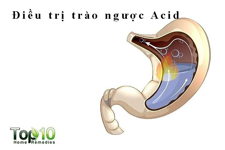 10 lợi ích sức khỏe ấn tượng của mù tạt vàng - Ảnh 7. 10 lợi ích sức khỏe ấn tượng của mù tạt vàng - Ảnh 7.