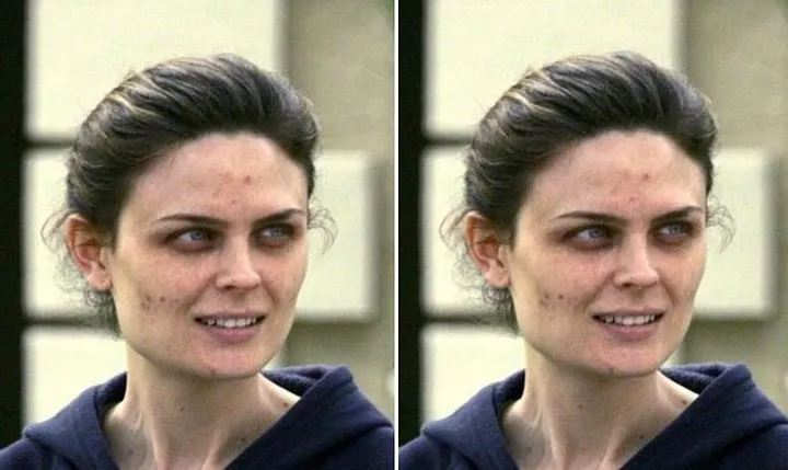 Khi loạt sao Hollywood đau đầu, &ldquo;khổ sở&rdquo; v&igrave; mụn trứng c&aacute; - Ảnh 10.