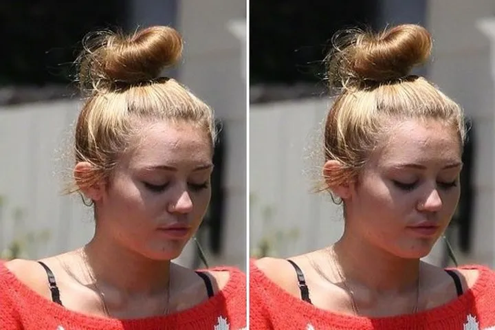 Khi loạt sao Hollywood đau đầu, &ldquo;khổ sở&rdquo; v&igrave; mụn trứng c&aacute; - Ảnh 12.