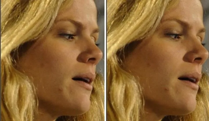 Khi loạt sao Hollywood đau đầu, &ldquo;khổ sở&rdquo; v&igrave; mụn trứng c&aacute; - Ảnh 13.