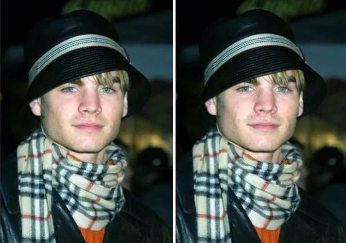 Khi loạt sao Hollywood đau đầu, &ldquo;khổ sở&rdquo; v&igrave; mụn trứng c&aacute; - Ảnh 15.