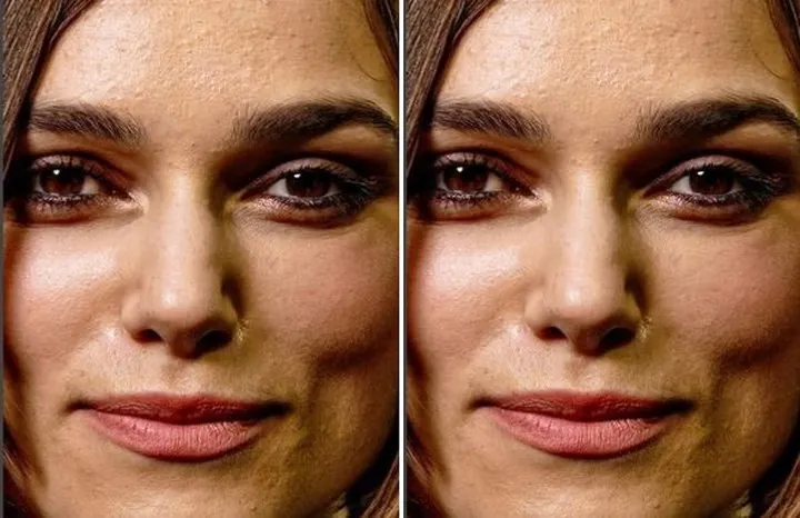 Khi loạt sao Hollywood đau đầu, &ldquo;khổ sở&rdquo; v&igrave; mụn trứng c&aacute; - Ảnh 4.