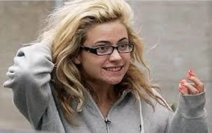 Khi loạt sao Hollywood đau đầu, &ldquo;khổ sở&rdquo; v&igrave; mụn trứng c&aacute; - Ảnh 8.