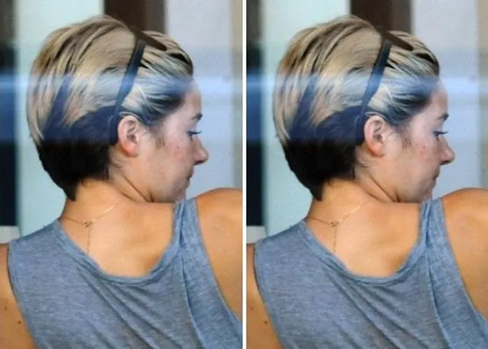 Khi loạt sao Hollywood đau đầu, &ldquo;khổ sở&rdquo; v&igrave; mụn trứng c&aacute; - Ảnh 9.