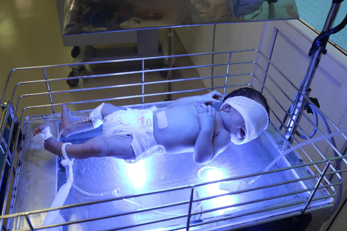 Thay máu kịp thời, cứu sống bệnh nhi 3 ngày tuổi bị vàng da - Ảnh 1. Thay máu kịp thời, cứu sống bệnh nhi 3 ngày tuổi bị vàng da - Ảnh 1.
