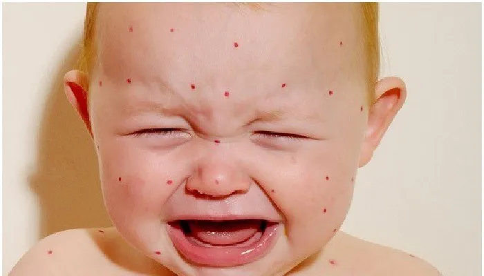 4 bệnh lý dễ khởi phát cần phòng tránh trong mùa hè - Ảnh 1.