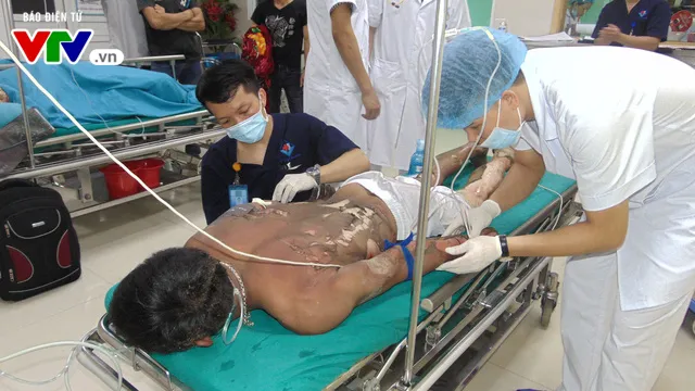 Cấp cứu cho bệnh nhân bị bỏng xăng nguy kịch tính mạng - Ảnh 1. Cấp cứu cho bệnh nhân bị bỏng xăng nguy kịch tính mạng - Ảnh 1.
