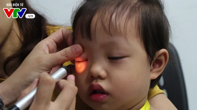 Khám và phẫu thuật mắt miễn phí cho gần 100 trẻ em ở Tuyên Quang - Ảnh 5. Khám và phẫu thuật mắt miễn phí cho gần 100 trẻ em ở Tuyên Quang - Ảnh 5.