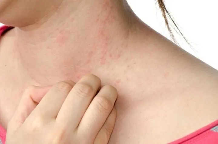 7 tác dụng phụ nghiêm trọng của hạnh nhân - Ảnh 6.