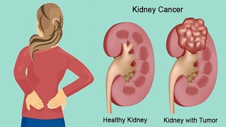 Hậu quả khôn lường khi nhịn ăn để giảm cân - Ảnh 9.