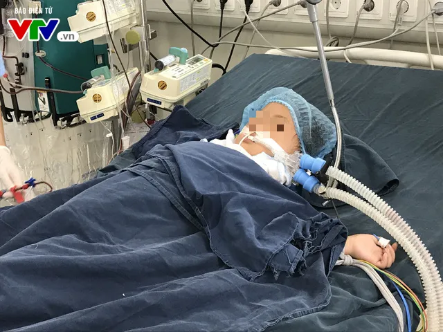3 trẻ nhập viện nguy kịch do bị ong đốt - Ảnh 1. 3 trẻ nhập viện nguy kịch do bị ong đốt - Ảnh 1.
