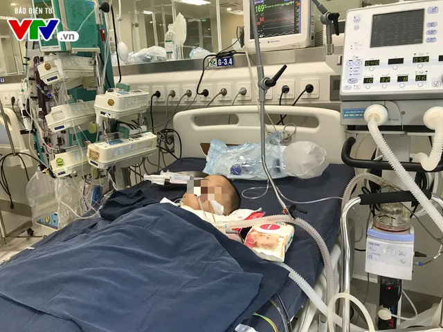 3 trẻ nhập viện nguy kịch do bị ong đốt - Ảnh 2. 3 trẻ nhập viện nguy kịch do bị ong đốt - Ảnh 2.