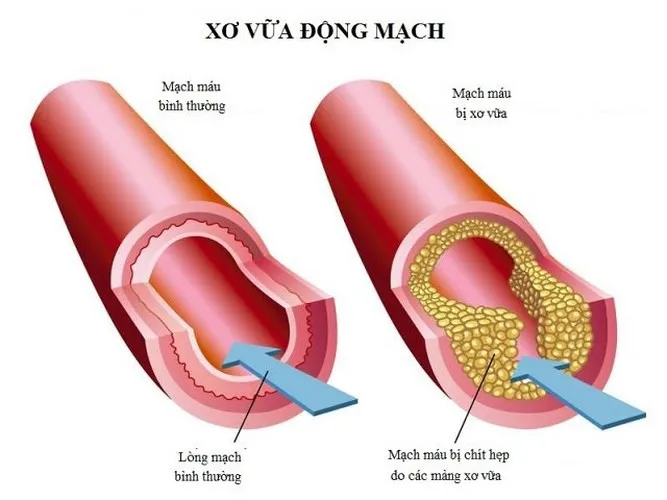 Lá sen - “Vị thuốc” bất ngờ chữa bách bệnh - Ảnh 2.