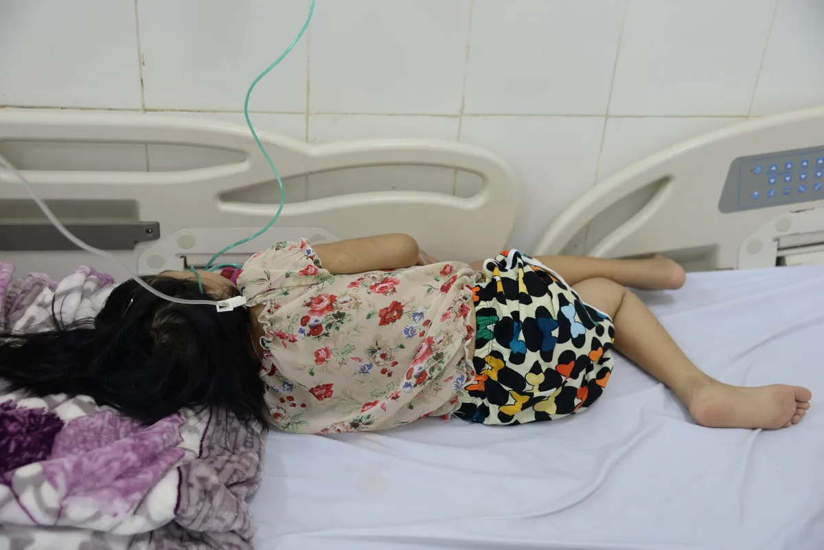 Cứu bệnh nhi mắc thalassemia và đái tháo đường nhiễm toan ceton - Ảnh 1.