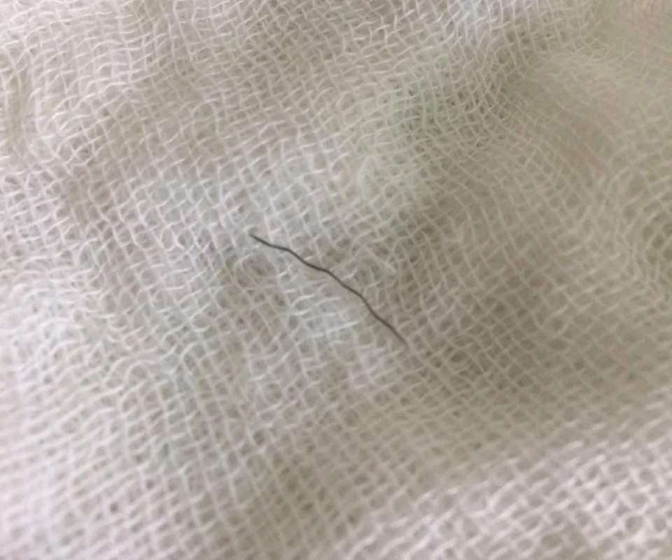 Lấy sợi dây sắt dài 2cm cắm sâu vào họng bé 11 tháng tuổi - Ảnh 1. Lấy sợi dây sắt dài 2cm cắm sâu vào họng bé 11 tháng tuổi - Ảnh 1.