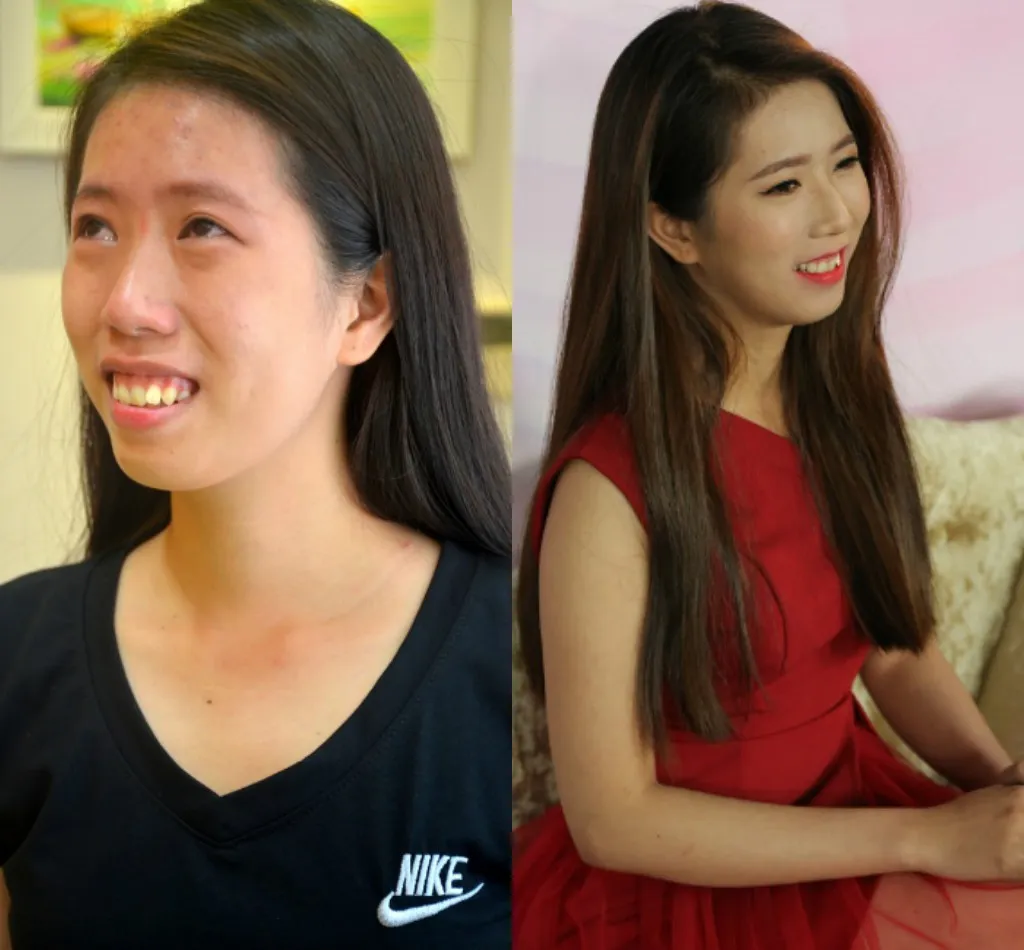 C&ocirc; g&aacute;i ngh&egrave;o v&agrave; h&agrave;nh tr&igrave;nh lấy lại nhan sắc - Ảnh 1.